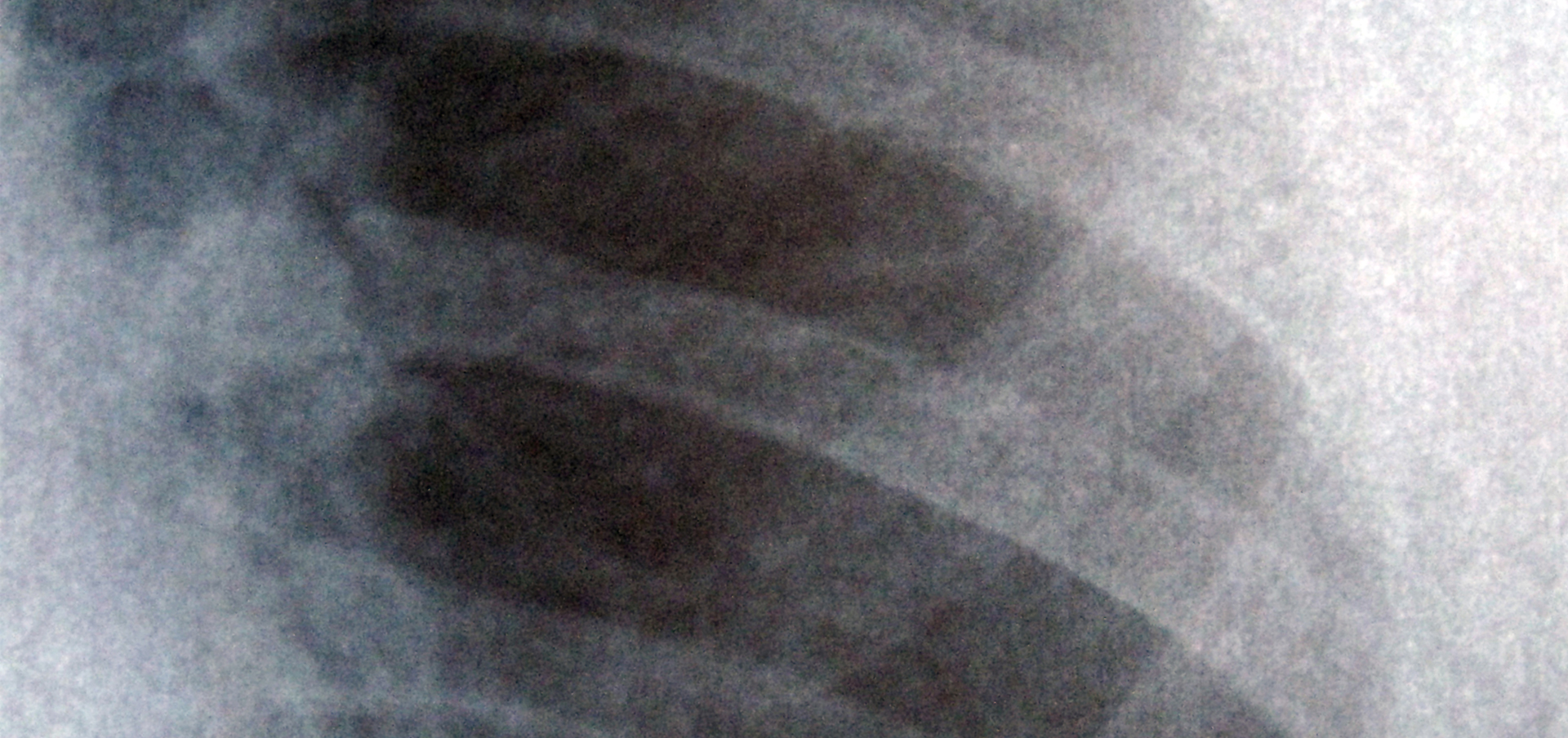 becoming a respiratory therapist in connecticut