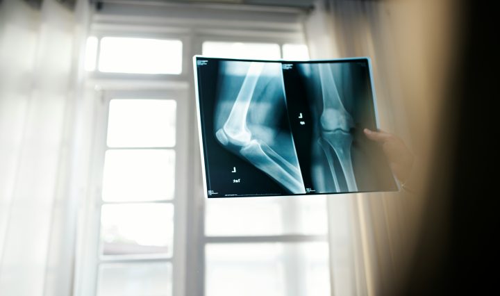 how much do radiologic technologists make