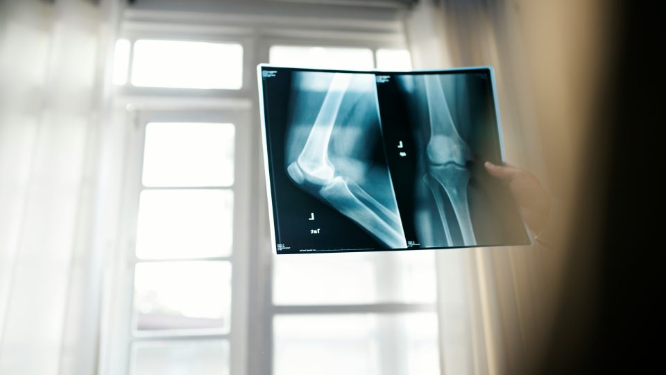 how much do radiologic technologists make