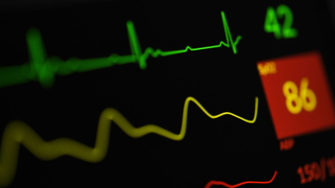What does a cardio-phlebotomy technician do at work