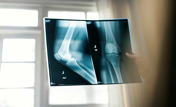 person holding an x-ray