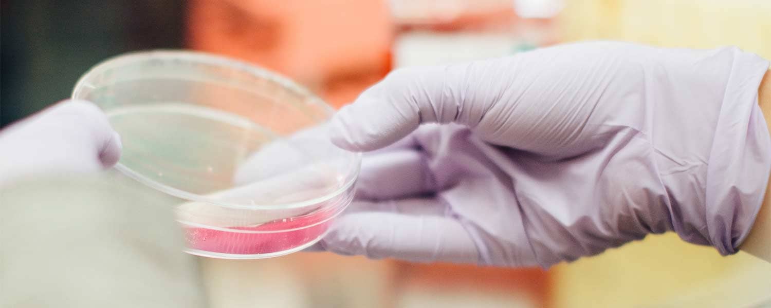 Closeup of a specimen in a petrie dish