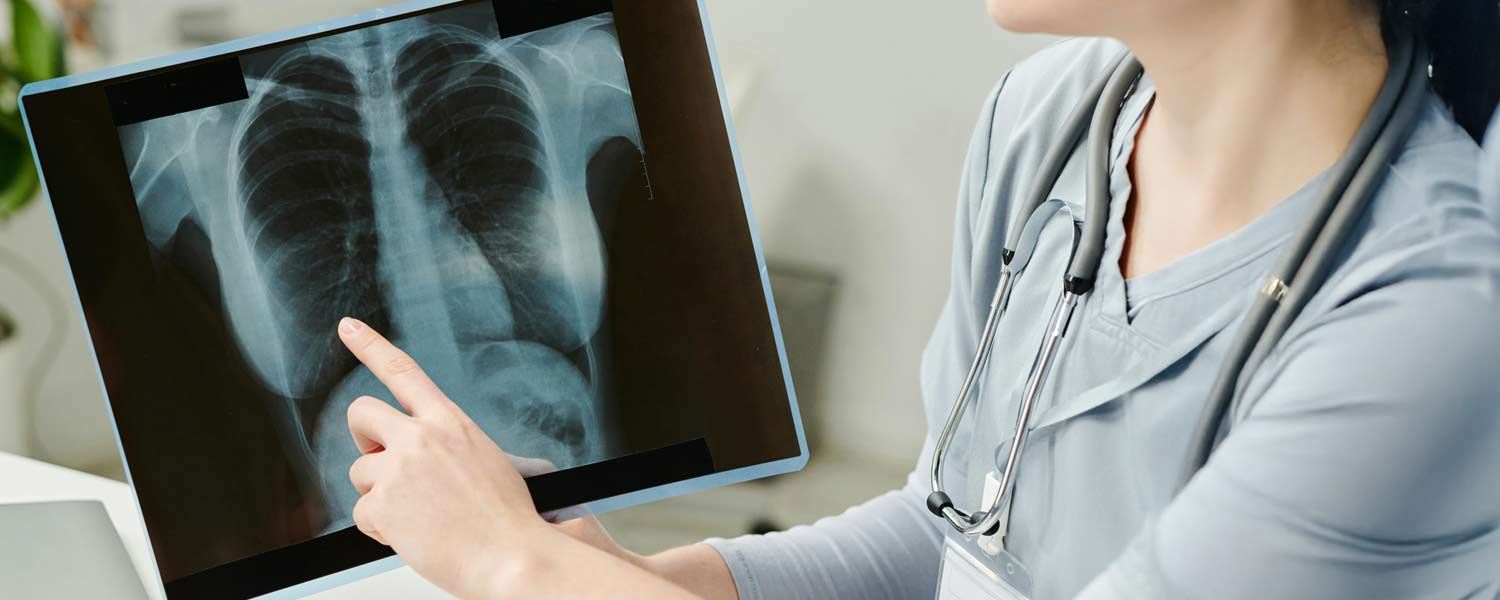 Student pointing to a region on an xray